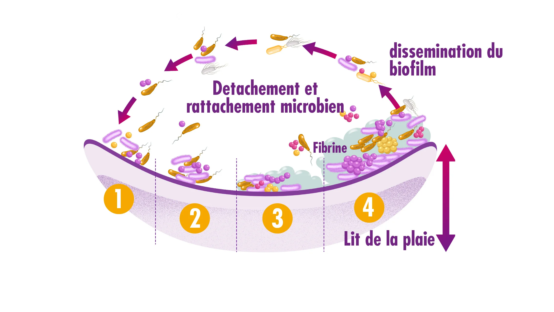 diagramme